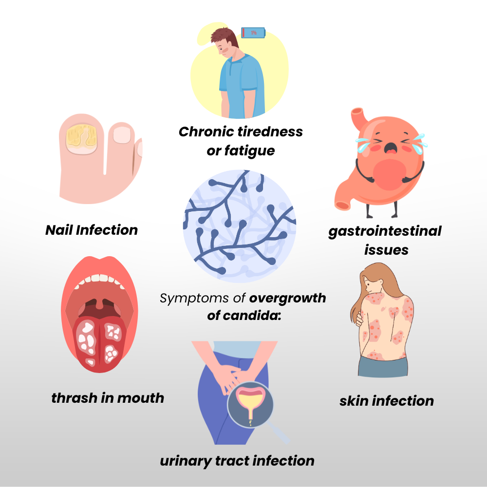 Candida Cleanse Gut & Colon Support